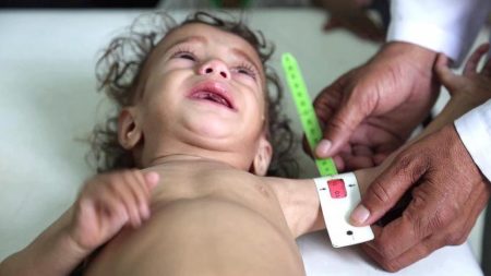 14 مليون يمني مهددون بالمجاعة نصفهم أطفال